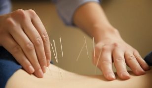 akupunktúra na prostatitídu
